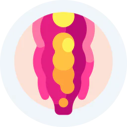 Medical icon illustration representing anal fissure, piles, or anorectal disease with a stylized cross-sectional view of the anal canal in pink and yellow colors.