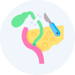 Medical illustration showing gallbladder surgery and cholecystectomy procedure with surgical instruments near the liver and bile ducts.