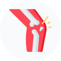 Medical illustration of a knee joint fracture showing broken bone injury, joint damage, pain, and orthopedic trauma condition.